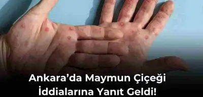 Ankara İl Sağlık Bakanlığı’ndan Açıklama Geldi! Ankara’da Maymun Çiçeği Görüldü İddialarını Yanıtladı!