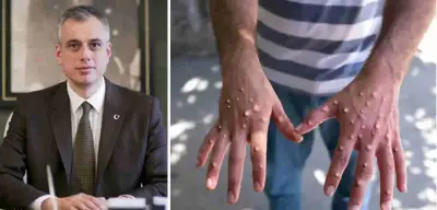 DSÖ’den “Acil Durum” Uyarısı! Maymun Çiçeği Virüsüne Bakanlıktan Açıklama Geldi